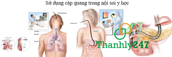 Sợi cáp quang và ứng dụng trong lĩnh vực Y tế